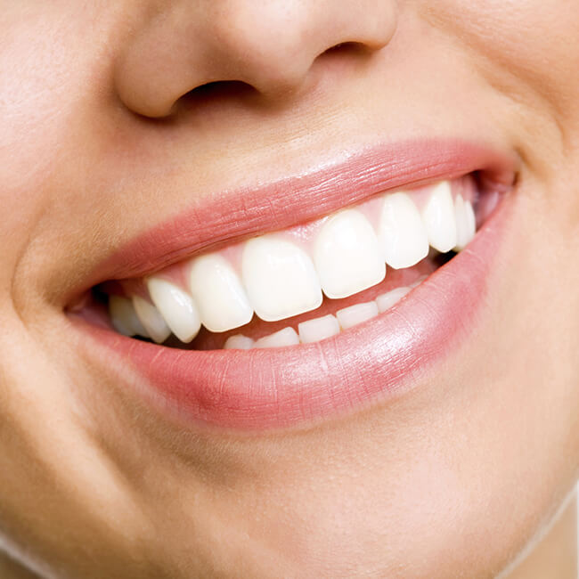 A woman with a close-up smile with white teeth