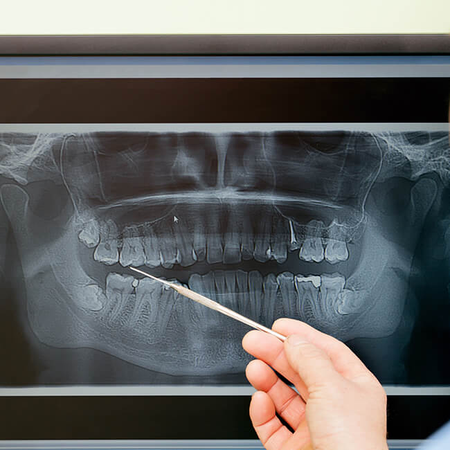 A dental team member holding a dental